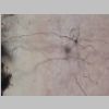 Neuronas Golgi 38.jpg